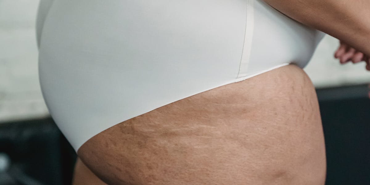 cueca para homem barrigudo